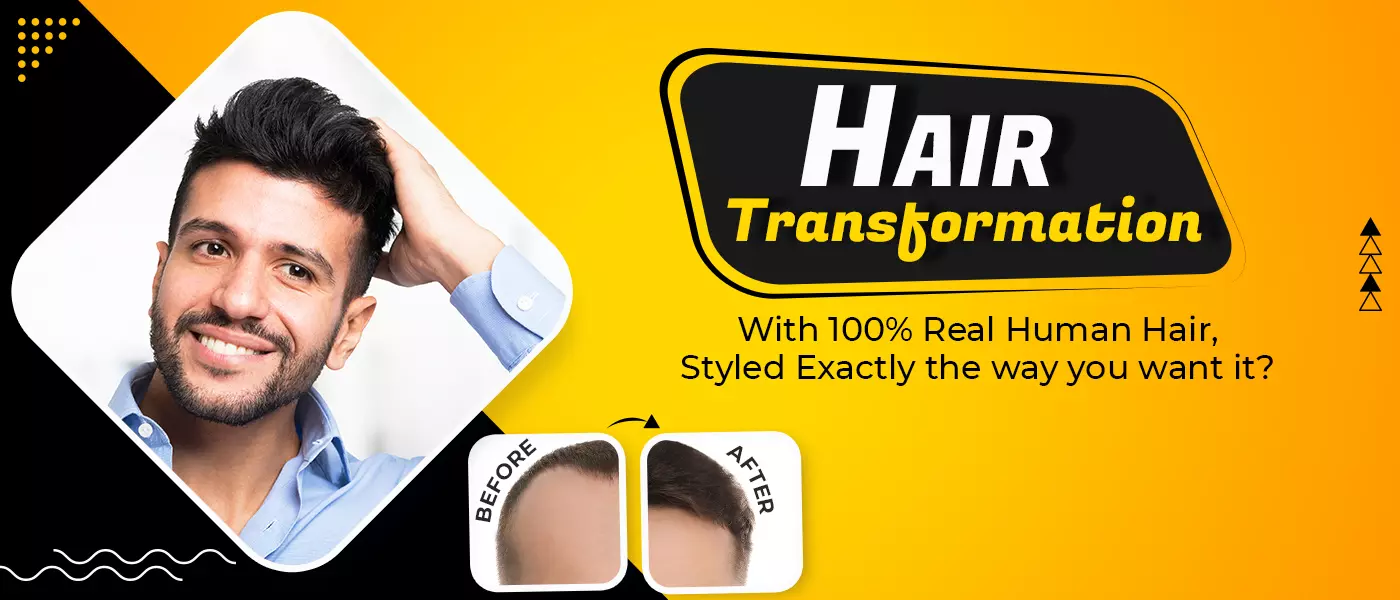 Non-Surgical Hair Replacement in Hyderabad, Bangalore | Hair Fixing & Hair Wigs - Bglam Hair Studio Non-Surgical Hair Replacement in Hyderabad, Bangalore | Hair Fixing & Hair Wigs - Bglam Hair Studio