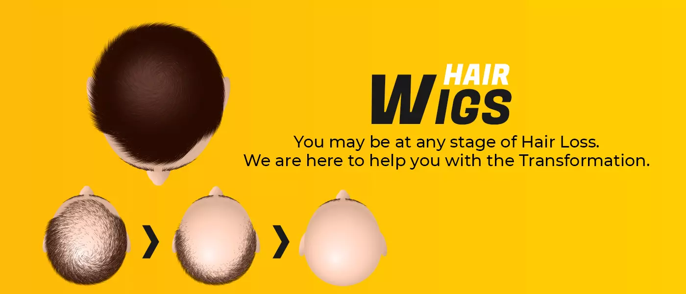 Non-Surgical Hair Replacement in Hyderabad, Bangalore | Hair Fixing & Hair Wigs - Bglam Hair Studio Non-Surgical Hair Replacement in Hyderabad, Bangalore | Hair Fixing & Hair Wigs - Bglam Hair Studio