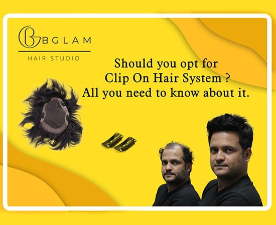 Should you opt for Clip On Hair System? All you need to know about it -  Bglam