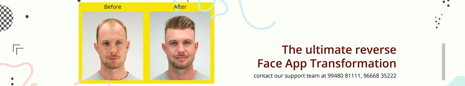 Best Hair Bonding in Hyderabad | Best Hair Patches in Hyderabad Best Hair Bonding in Hyderabad | Best Hair Patches in Hyderabad