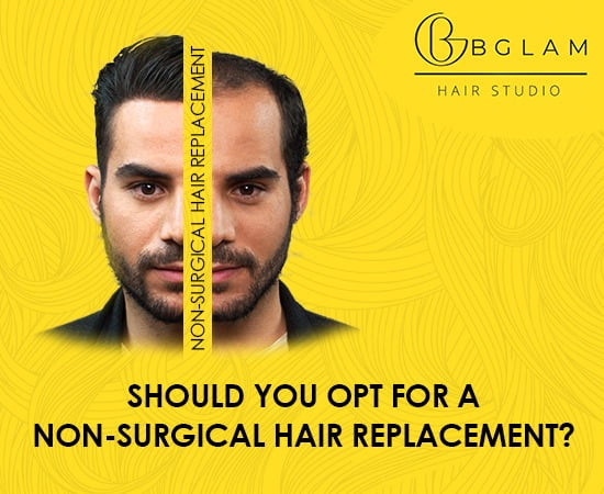 Should you opt for a Non-Surgical Hair Replacement? - Bglam Should you opt for a Non-Surgical Hair Replacement? - Bglam