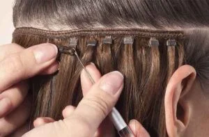 hair restoration without surgery in hyderabad