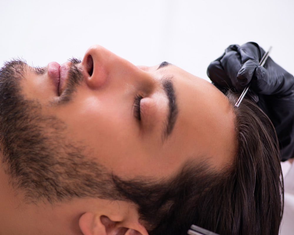 Permanent hair extensions Hyderabad