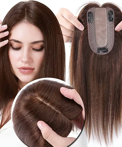 hair replacement service in Hyderabad