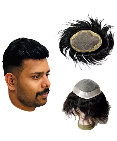 Hair implantation services nearby