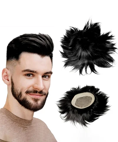 Wigs for women with hair loss in Hyderabad