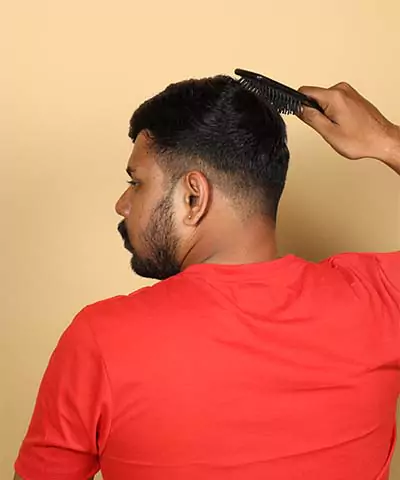 Hair replacement in Hyderabad