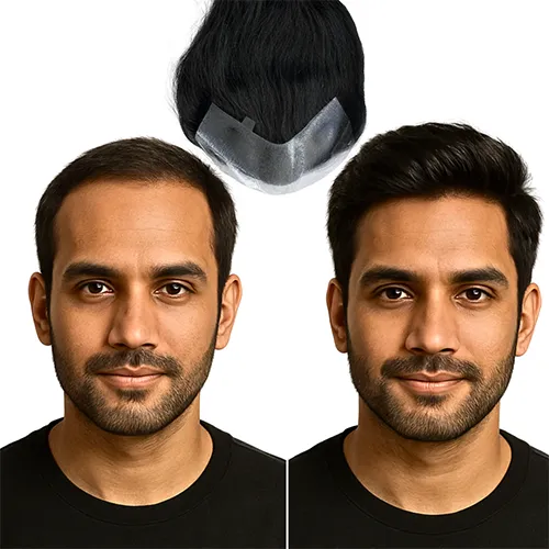 Hair Patch Services in Banashankari