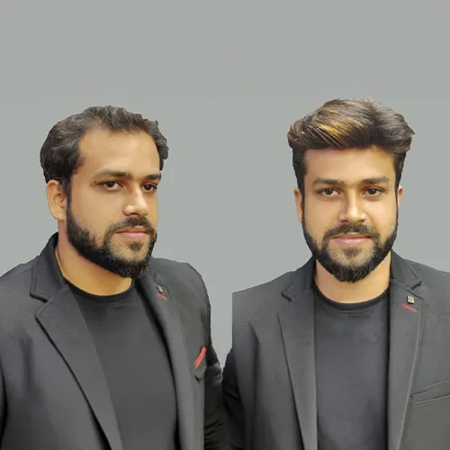 Hair Patch Near Miyapur
