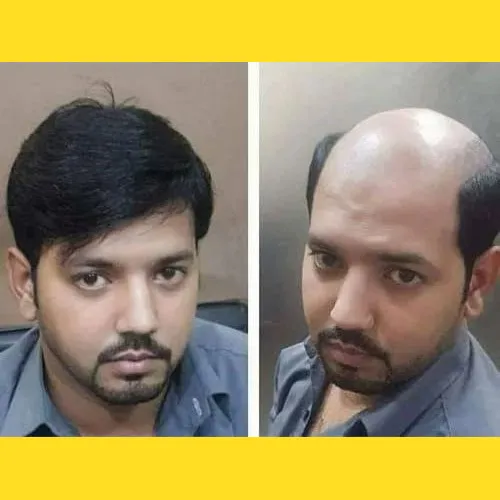 Hair Wigs In HSR