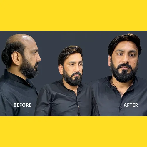 Hair Wigs In Jaya Nagar