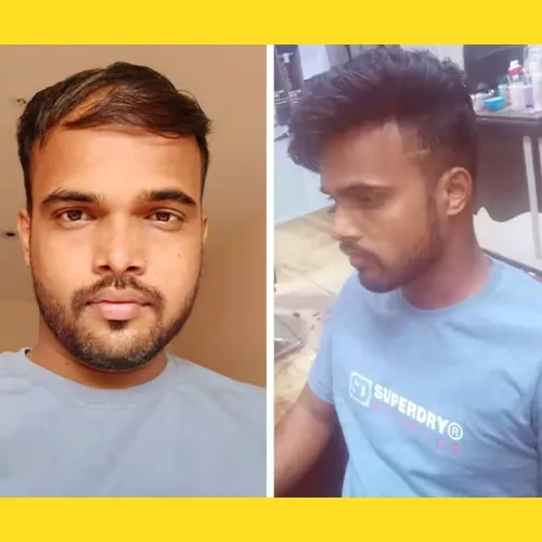 Hair Wigs In Koramangala