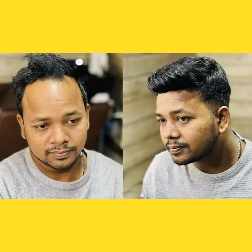 Hair Wigs In Malleshwaram