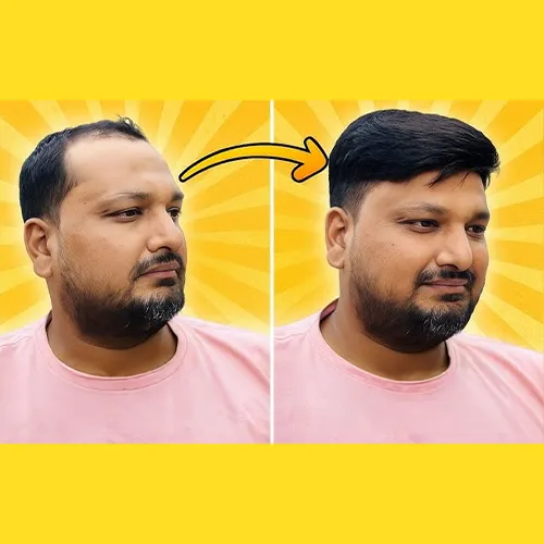 Hair Wigs In Marathahalli
