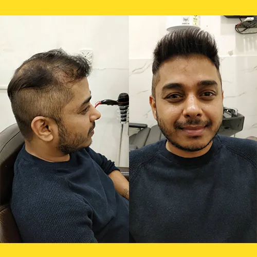 Hair Wig in Rajaji Nagar