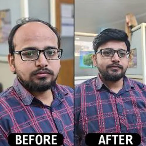 Hair Wigs Men