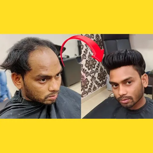 Hair Wig Shop Near Rasoolpura