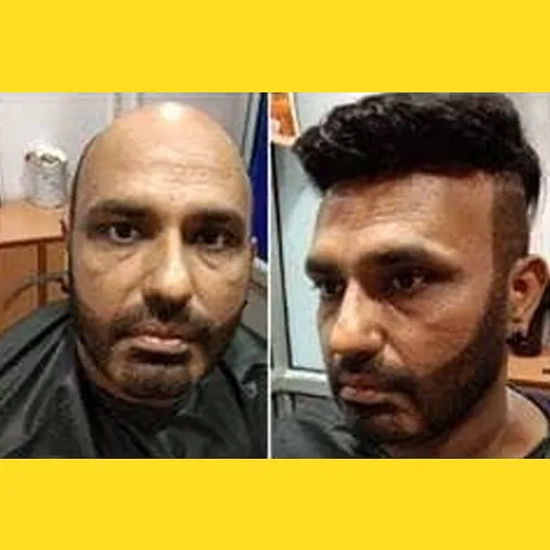 Hair Wigs In BHEL