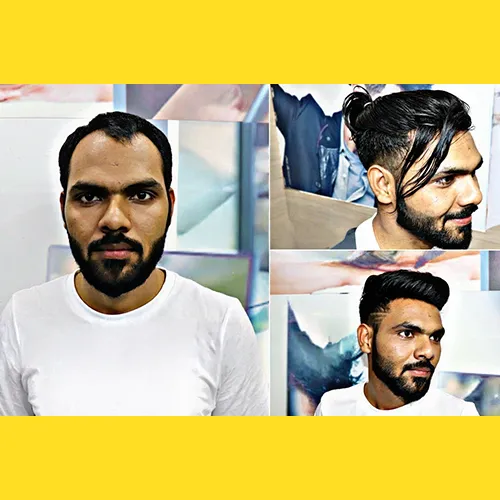 Hair Wigs In Secunderabad