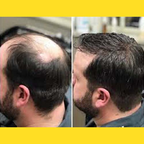 Hair Wig Shop Near Prakash Nagar