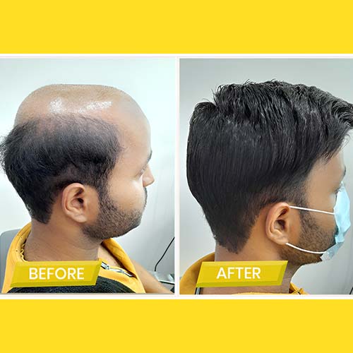 Hair Wigs In Siddapura
