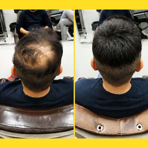 Hair Wigs In RR Nagar