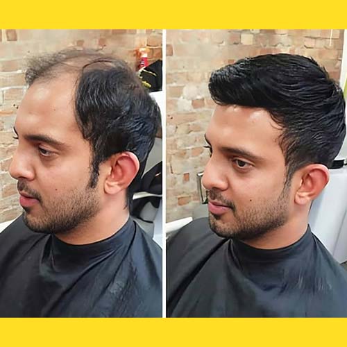 Hair Wigs Near Jayanagar