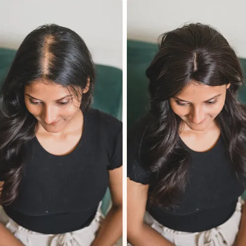Ladies Hair Wigs In Bangalore